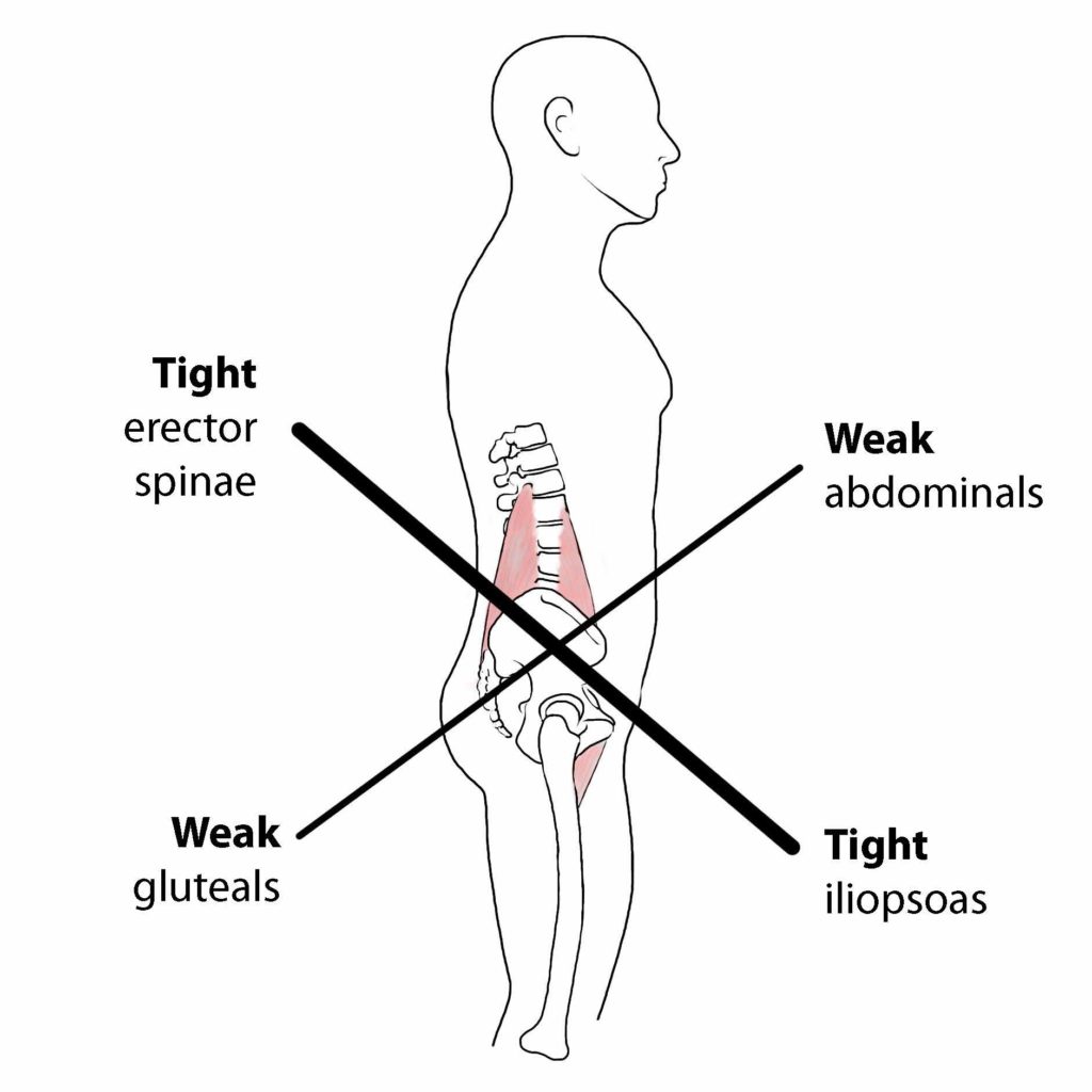 Tips For Proper Body Alignment To Avoid Back & Hip Pain